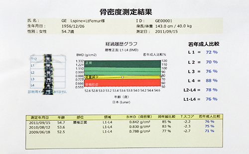 骨密度測定結果[図]