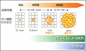 PET検査とは[図]