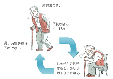 間欠跛行が特徴[図]