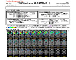 MRI3[写真]