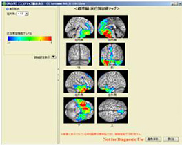 MRI4[写真]