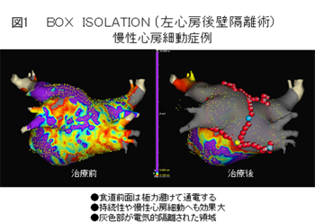 BOX ISOLATION