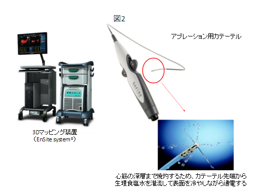 3Dマッピング装置/アブレーション用カテーテル